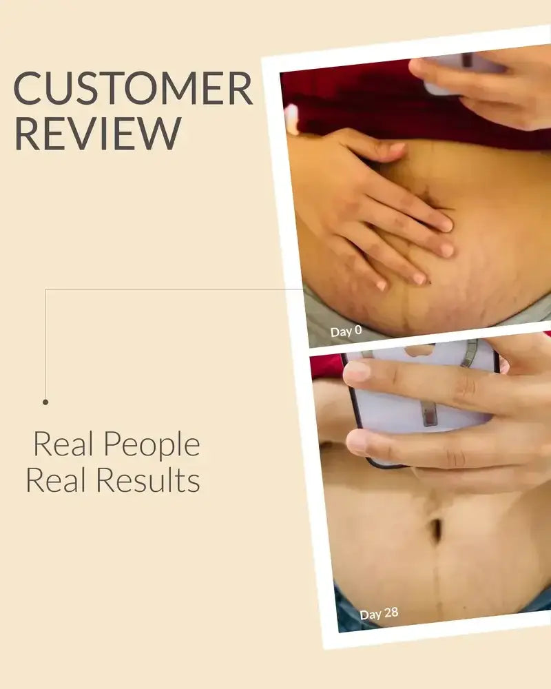 Customer Reviews of stretch marks cream