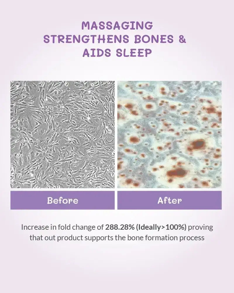 Before and after images of bone tissue with text about product's effect on bone strength and sleep.