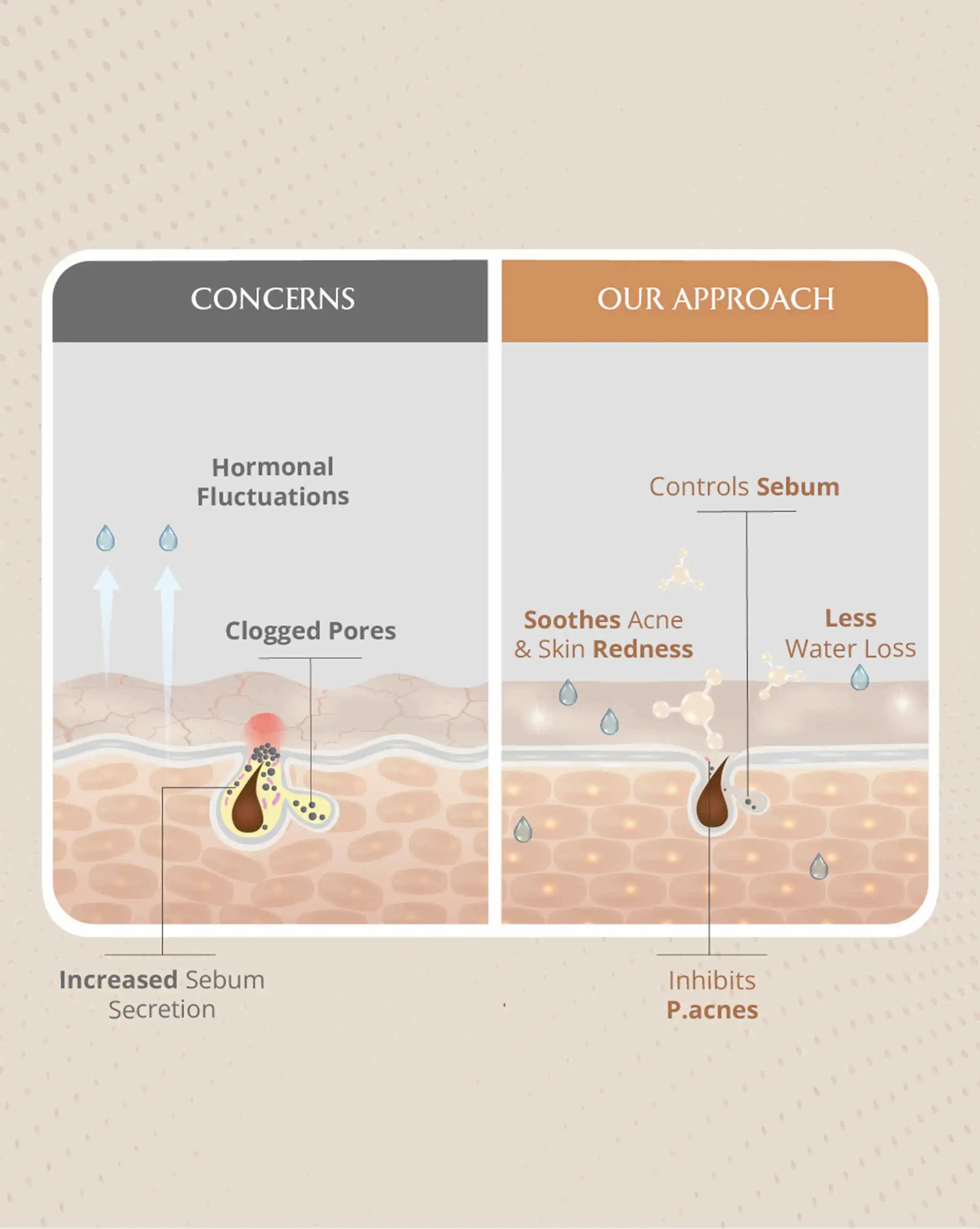 Diagram showing skin concerns and an approach to addressing them on a beige background