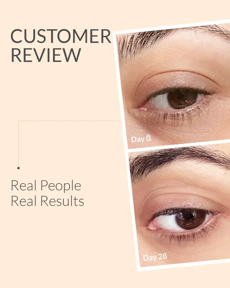 Before and after comparison of an eye treatment with 'Day 0' and 'Day 28' labels.