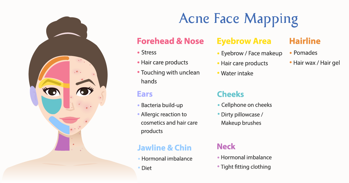 A Guide To Face Mapping: What Your Acne Means