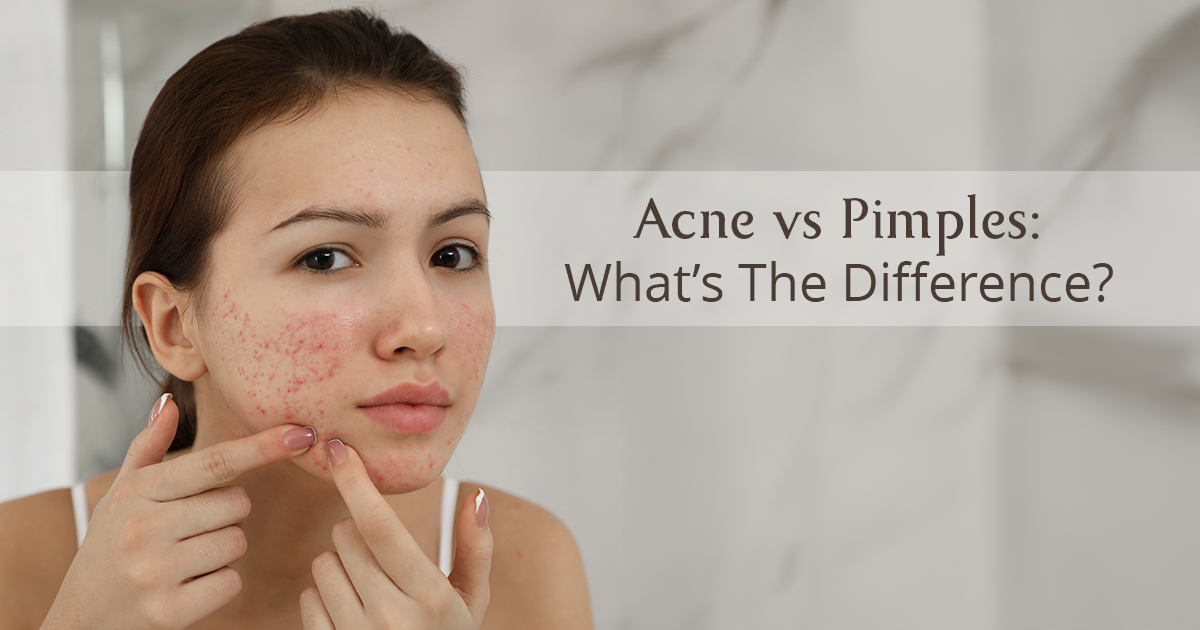 Acne Vs Pimples: What’s The Difference?