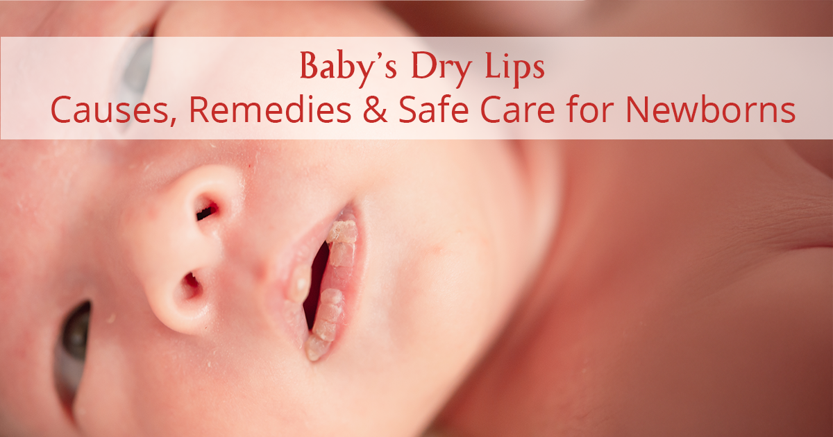 How to Treat Dry Chapped Lips on a Newborn Baby