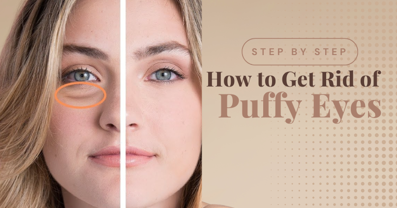 7 Common Causes of Puffy Eyes & How to Depuff Them