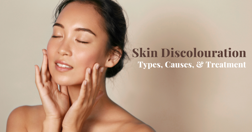 Skin Discolouration: Types, Causes, & Treatment Options