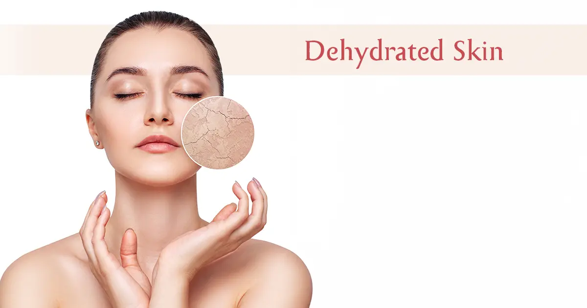 Dehydrated Skin: Causes, Symptoms & Best Hydrating
