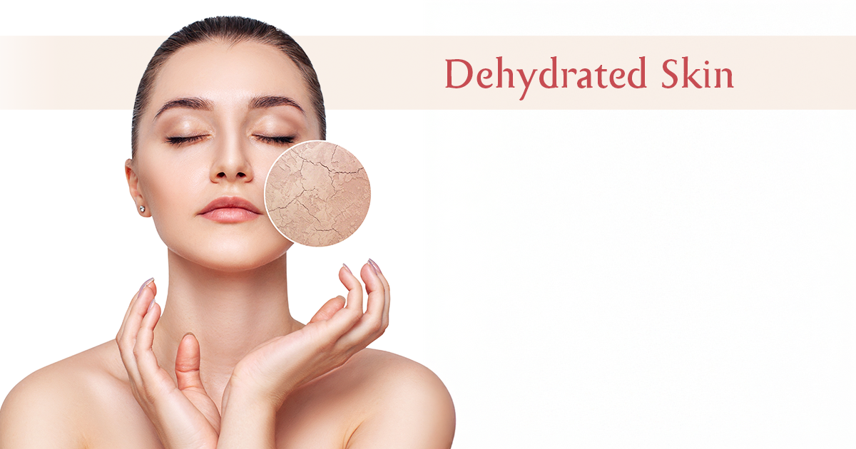 Dehydrated Skin: Causes, Symptoms & Best Hydrating