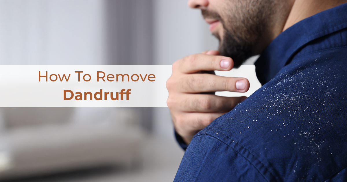 How To Remove Dandruff: Effective Tips