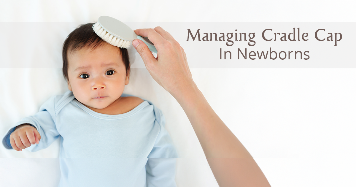 Cradle cap in newborns