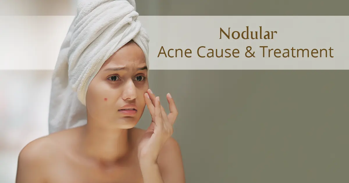 Nodular Acne
