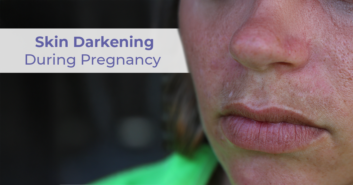 Is Skin Darkening During Pregnancy Normal? Everything You Need to Know