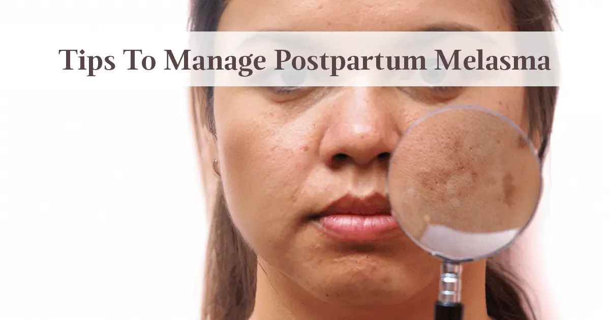 Defeat Postpartum Melasma With These 6 Simple Steps!
