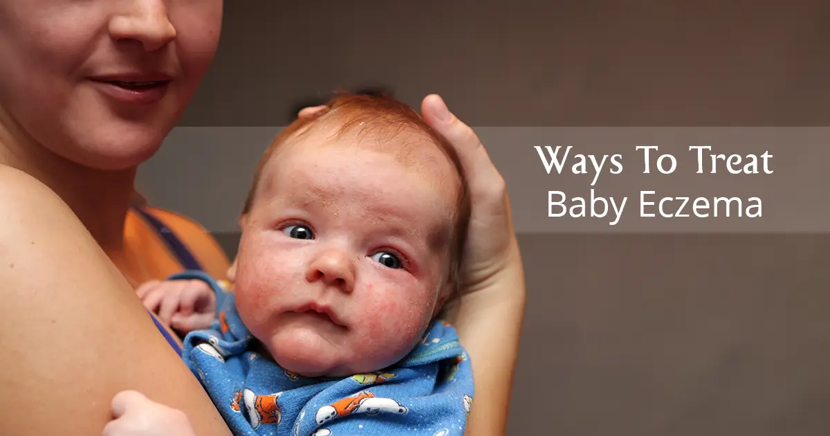 Baby Eczema: All You Need To Know