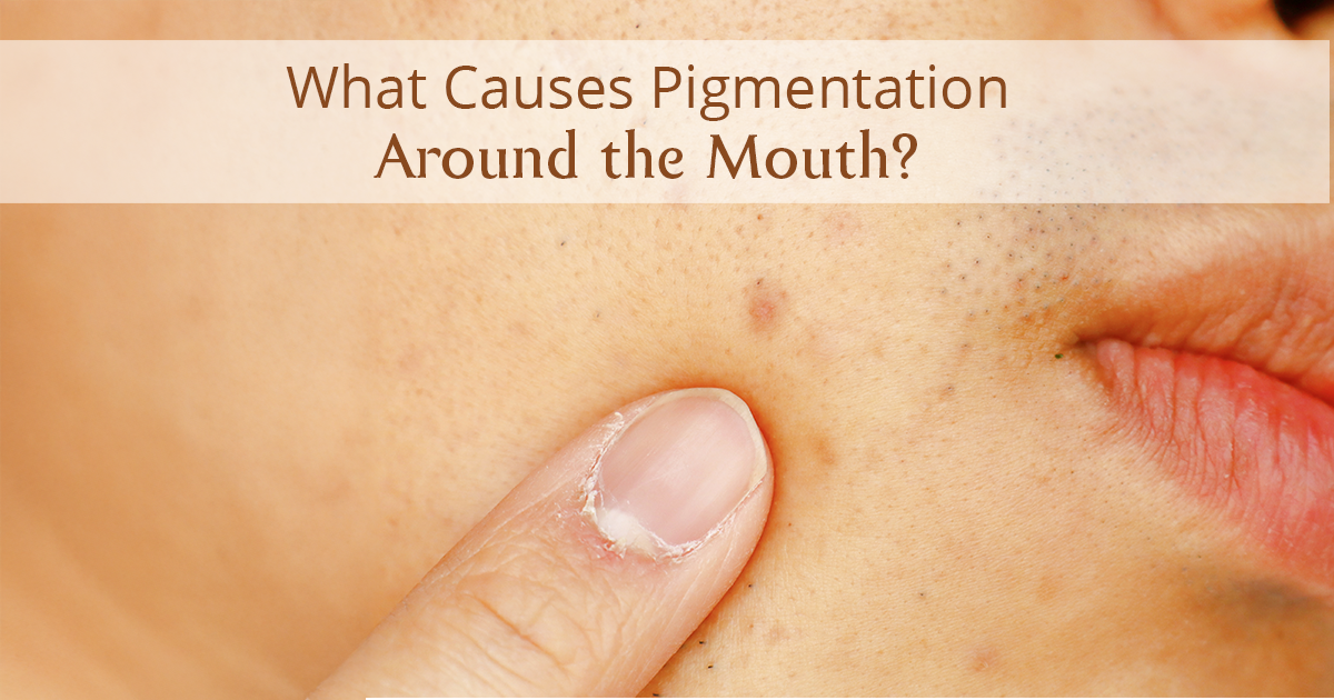 how to remove pigmentation around mouth