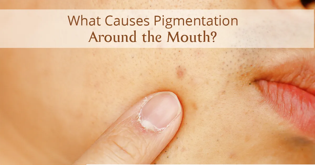 how to remove pigmentation around mouth