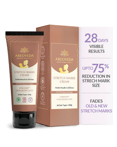 Stretch Marks Cream 100g