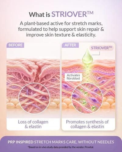 Stretch Marks Cream