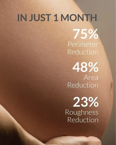 Advertisement showing a person's skin with text indicating 75% perimeter reduction, 48% area reduction, and 23% roughness reduction in just one month.