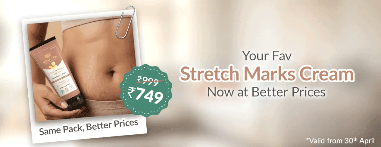 Advertisement for stretch marks cream with a price tag and promotional text.