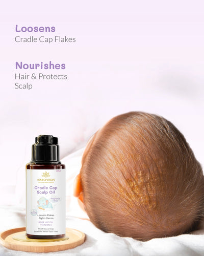 Cradle cap scalp oil bottle with a child's head on a white background