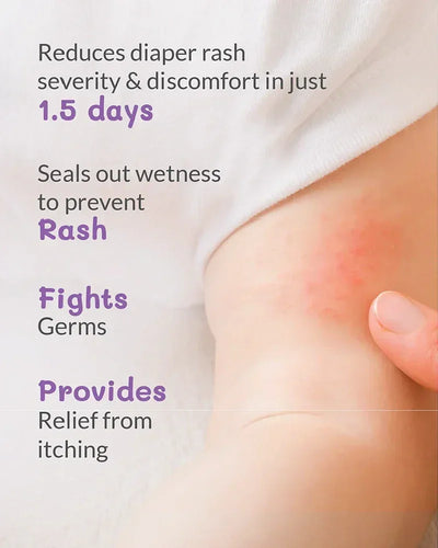 Diaper rash on a baby's skin with text highlighting product benefits