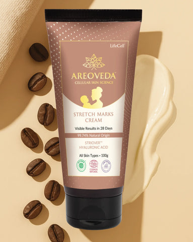 Stretch Marks Cream 100g