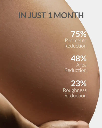 Advertisement showing skin reduction statistics with a close-up of skin texture.