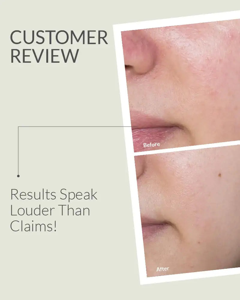 Before and after comparison of skin treatment on a beige background with text 'Customer Review' and 'Results Speak Louder Than Claims!'.