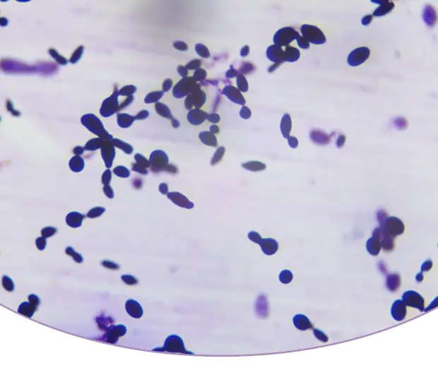 Dandruff Test Anti Dandruff Test – AreoVeda
