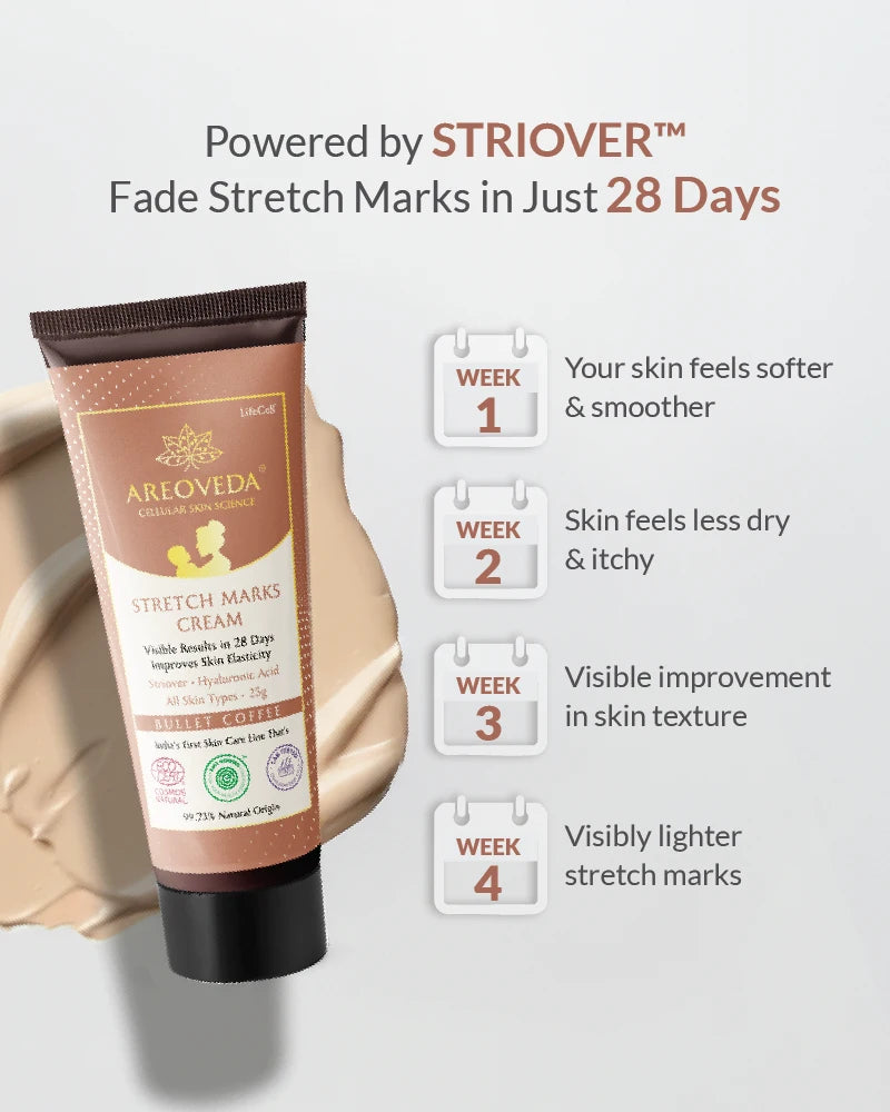 Areoveda stretch marks cream with Striover technology claims on a light gray background